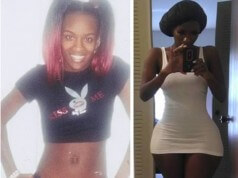 Cirurgias plásticas extremas e seus resultados