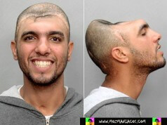 Conheça Carlos Rodriguez, o homem que vive sem metade da cabeça