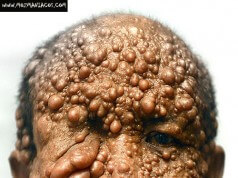 Conheça Lauw Tjoan Eng, Um Homem Que Você Não Vai Gostar de Ver