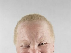 Fotos de Lindos Albinos Africanos