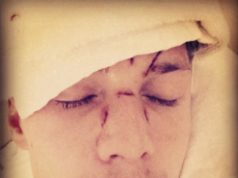 Irmão de Paris Hilton quer processar Lindsay Lohan por agressão