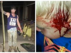 Uma Cobra Mordeu a Cabeça Desta Criança Enquanto Ela Dormia