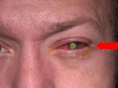 Por Um Simples Erro Homem Acorda Sem Visão