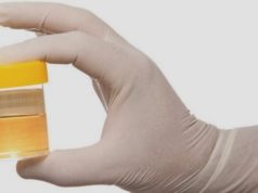 Conheça os 8 tipos de testes de gravidez caseiro