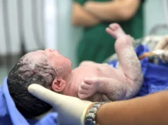 Resto de parto no bebé: O que é e como identificar?